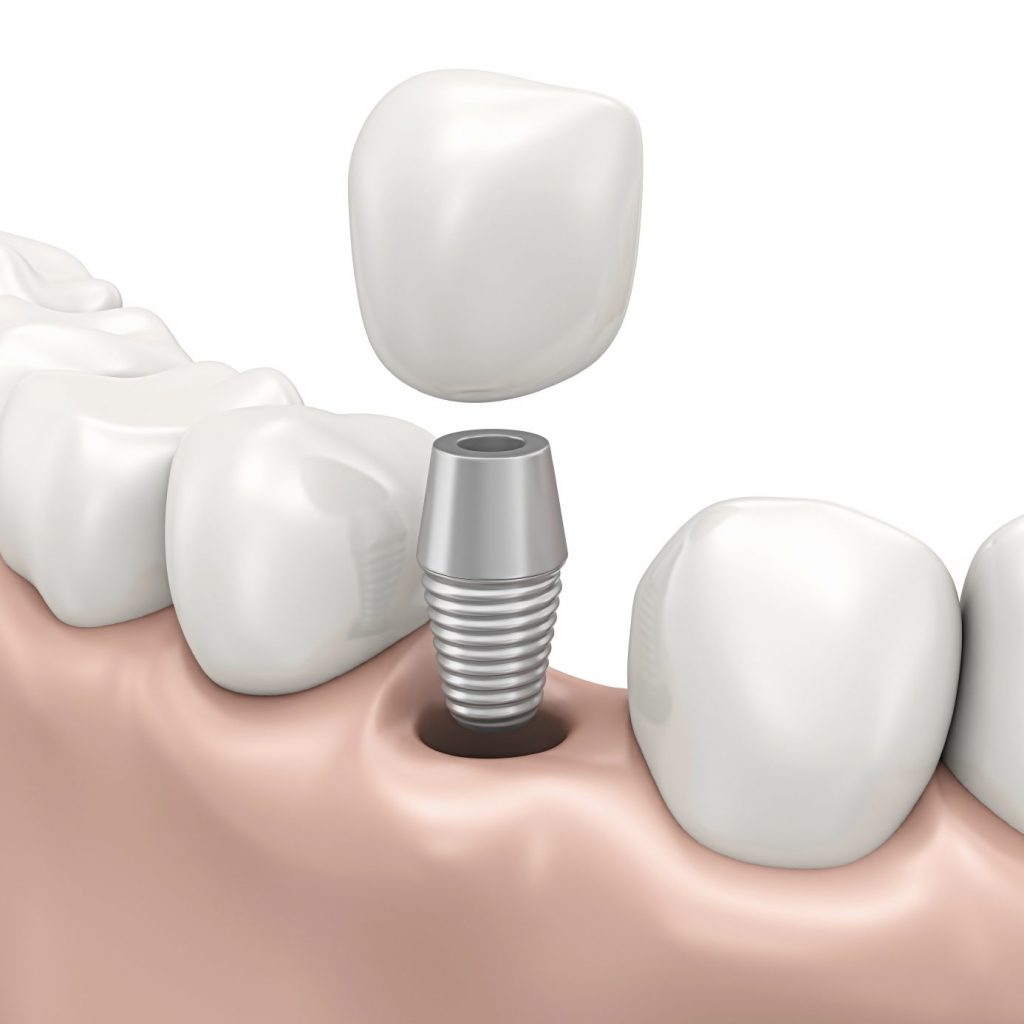 Park Ridge Dental.jpg Park Ridge Dental at Loukas Dentistry in Park Ridge IL