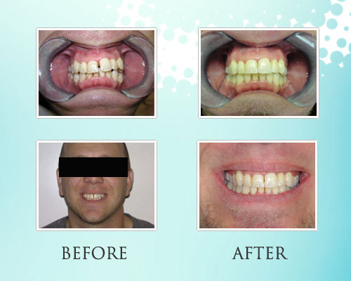 Park Ridge Invisalign