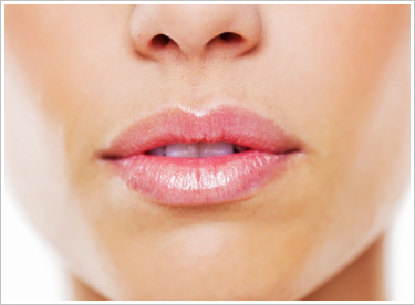juvederm-lips