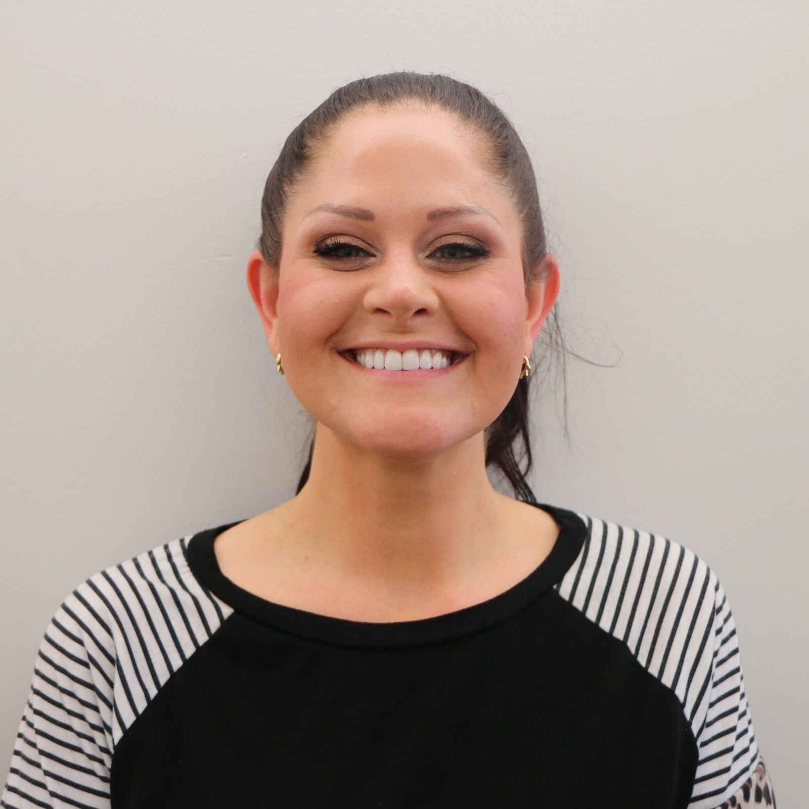 Facial aesthetics and Kybella patient result at Loukas Dentistry in Park Ridge