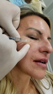 Botox treatment video thumbnail at Loukas Dentistry of Park Ridge