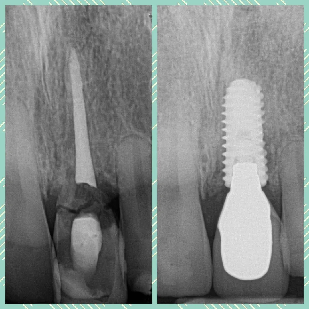 Dental X-ray imaging used for diagnosis at Loukas Dentistry in Park Ridge