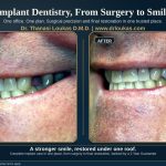 .jpg at Loukas Dentistry in Park Ridge IL