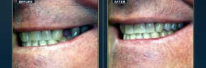 .jpg at Loukas Dentistry in Park Ridge IL
