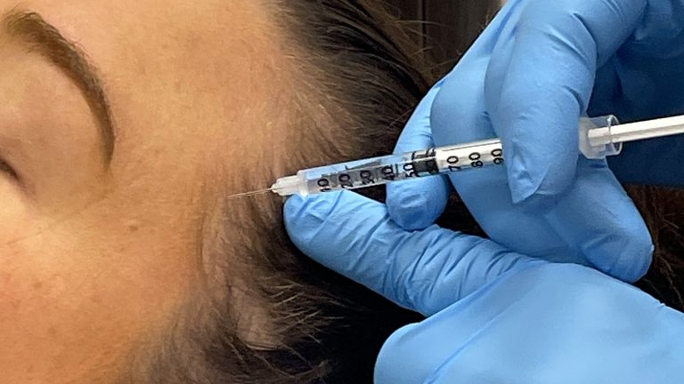 Forehead Botox treatment at Loukas Dentistry in Park Ridge IL