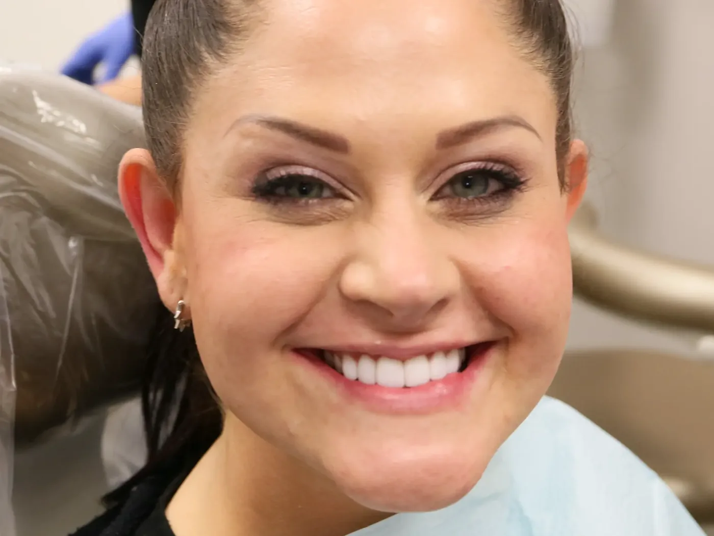 Porcelain veneers smile result at Loukas Dentistry in Park Ridge