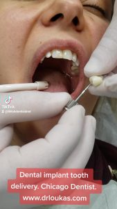 Close-up of a patient’s open mouth during a dental implant procedure, with gloved hands and dental instruments nearby.