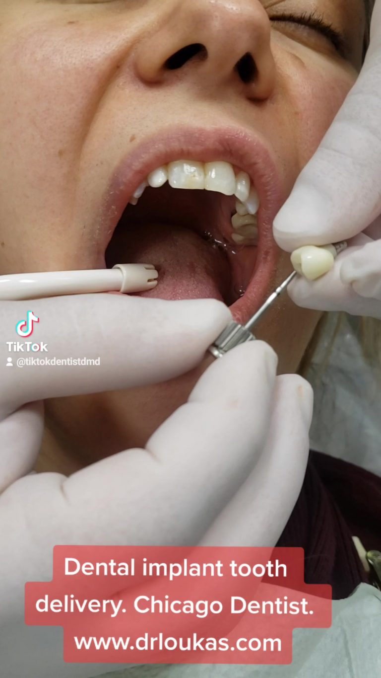 Close-up of a patient’s open mouth during a dental implant procedure, with gloved hands and dental instruments nearby.