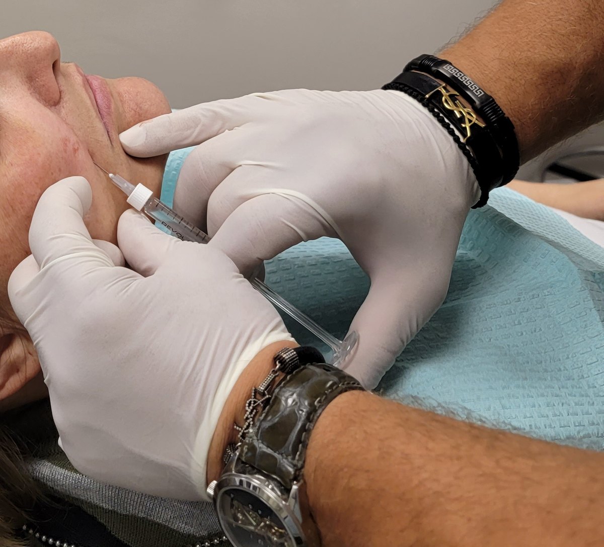 Dr. Thanasi Loukas placing PDO threads along a patient's lower face in the treatment room at Loukas Dentistry in Park Ridge, IL