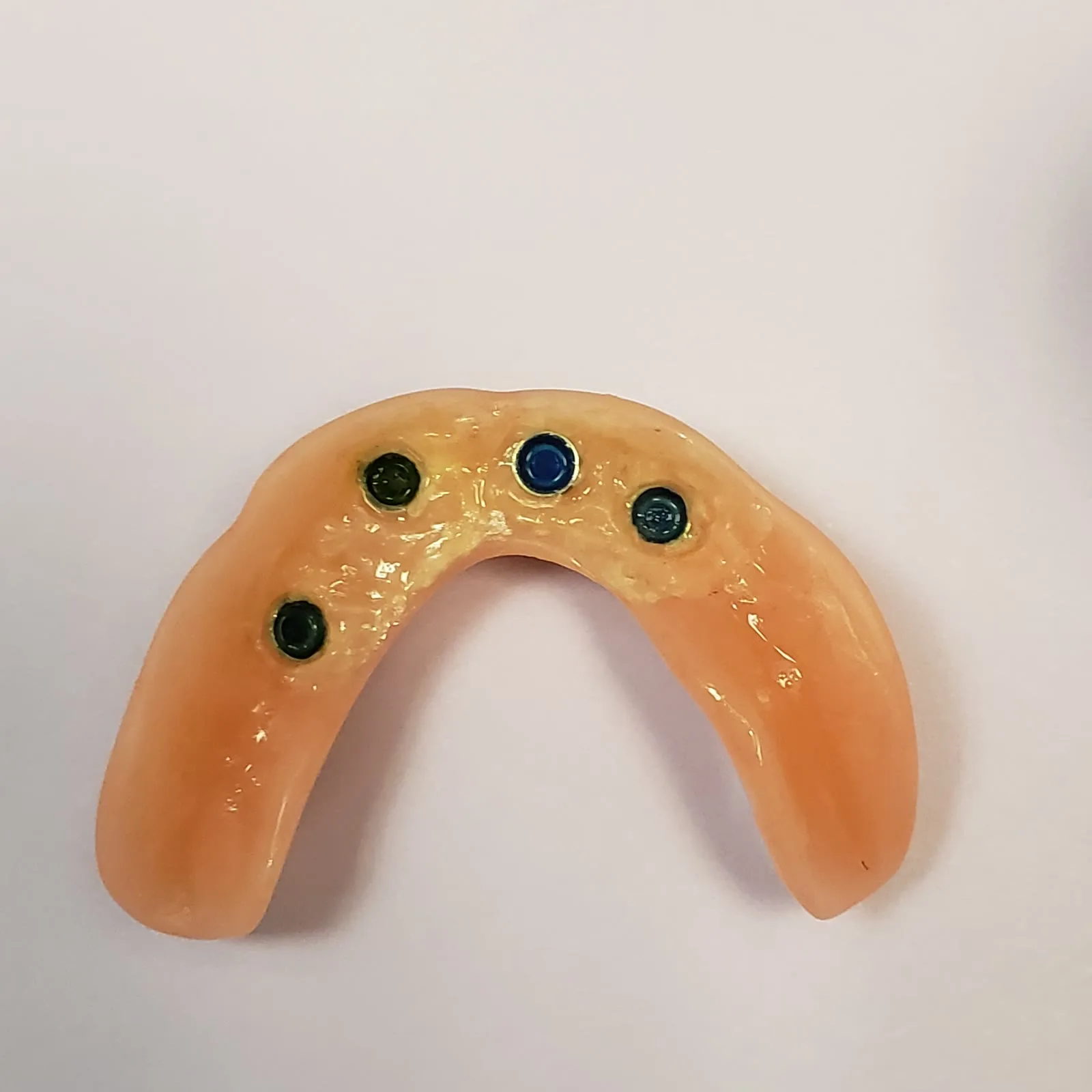Implant Overdenture with Locator Housings Park Ridge Il Loukas Dentistry of Park Ridge Underside of an implant-supported lower denture showing four Locator attachment housings