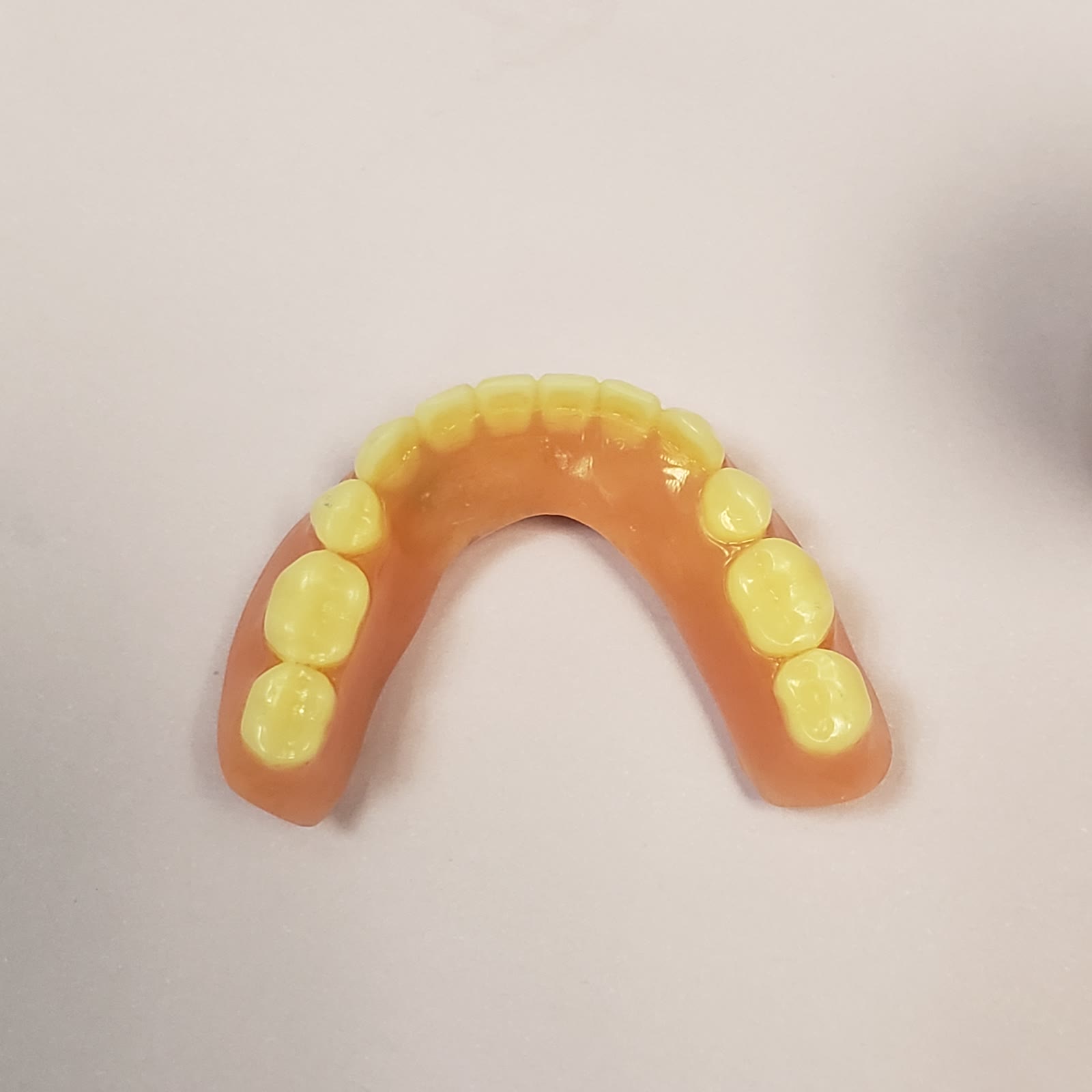 Implant-supported lower denture (snap-in overdenture) made at Loukas Dentistry of Park Ridge, IL