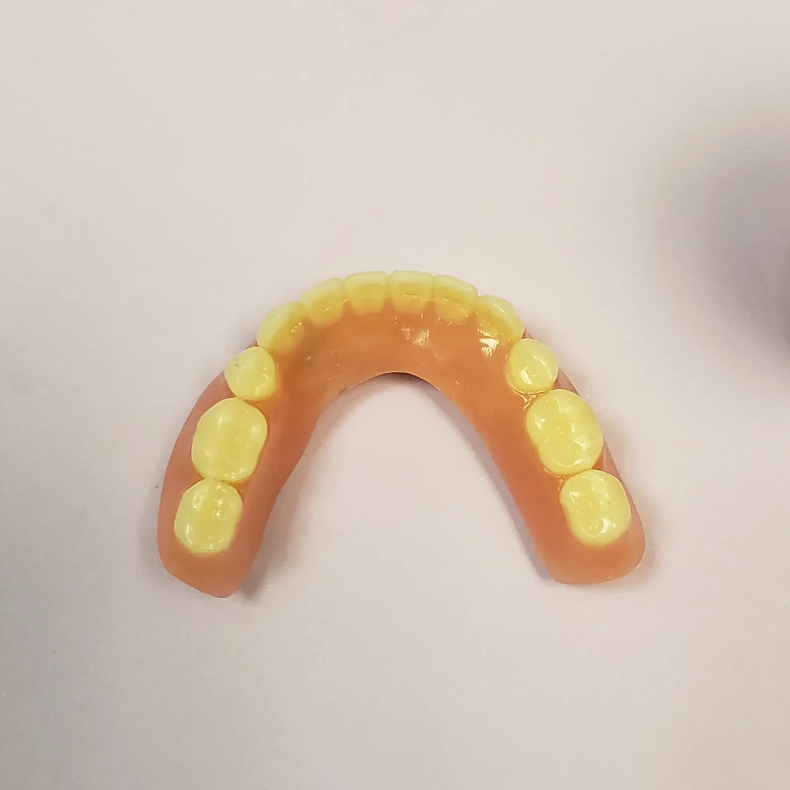 Implantsupported Lower Denture Park Ridge Il Loukas Dentistry of Park Ridge Finished implant-supported lower denture (snap-in overdenture) made at Loukas Dentistry of Park Ridge, IL