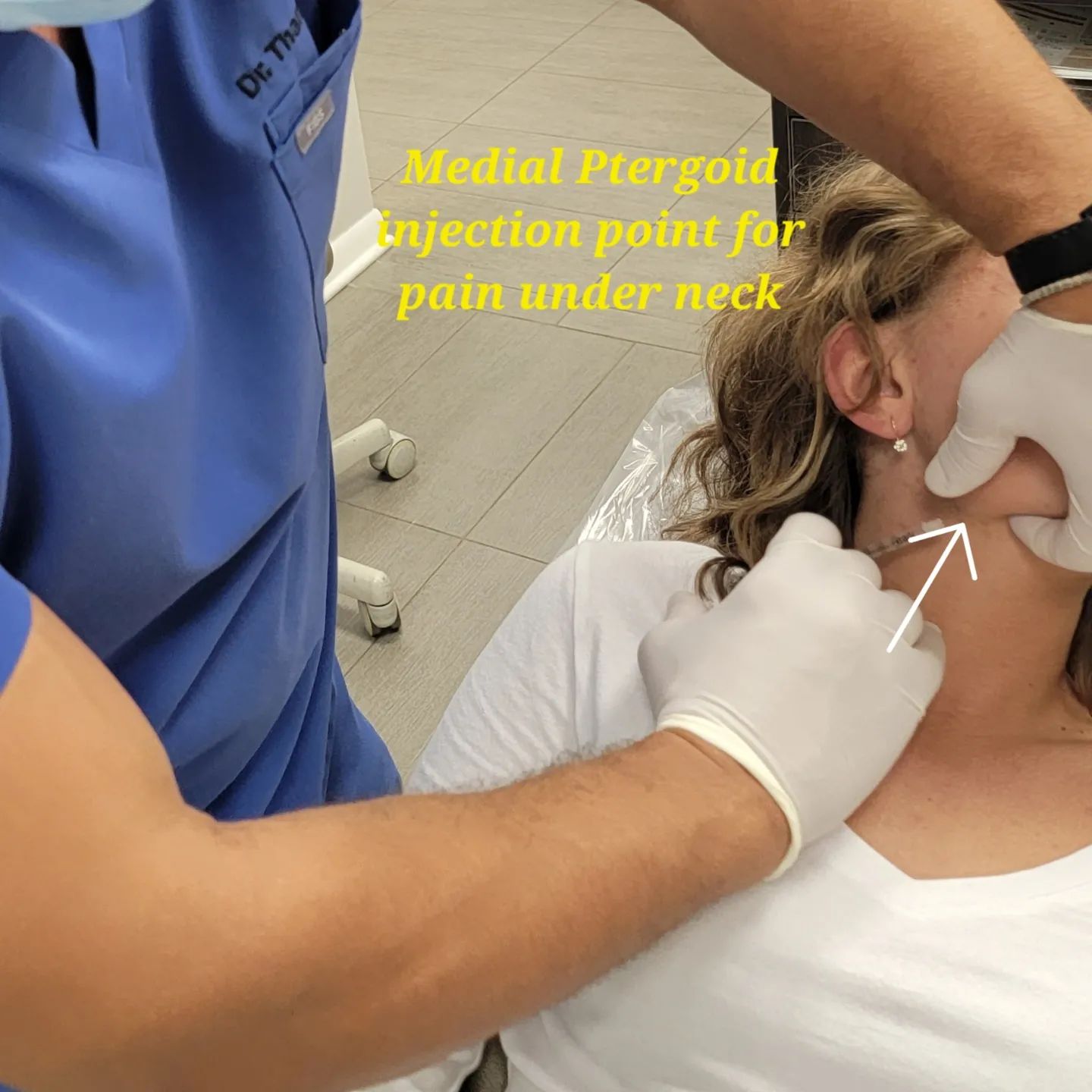 Medial pterygoid injection point used to treat jaw and neck pain, Loukas Dentistry of Park Ridge, Illinois