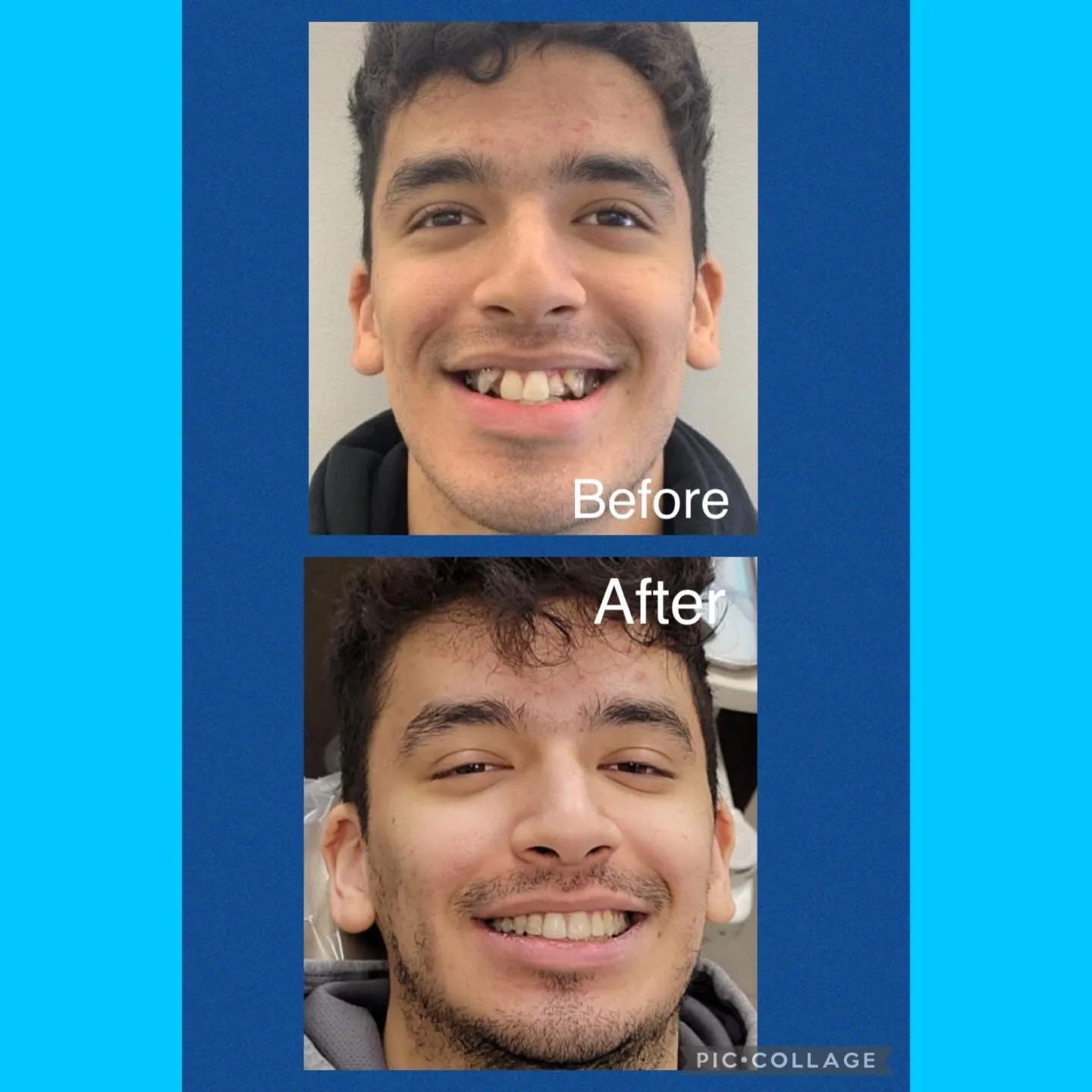 Before and after portraits showing a smile transformed by orthodontic treatment, Loukas Dentistry of Park Ridge, Illinois