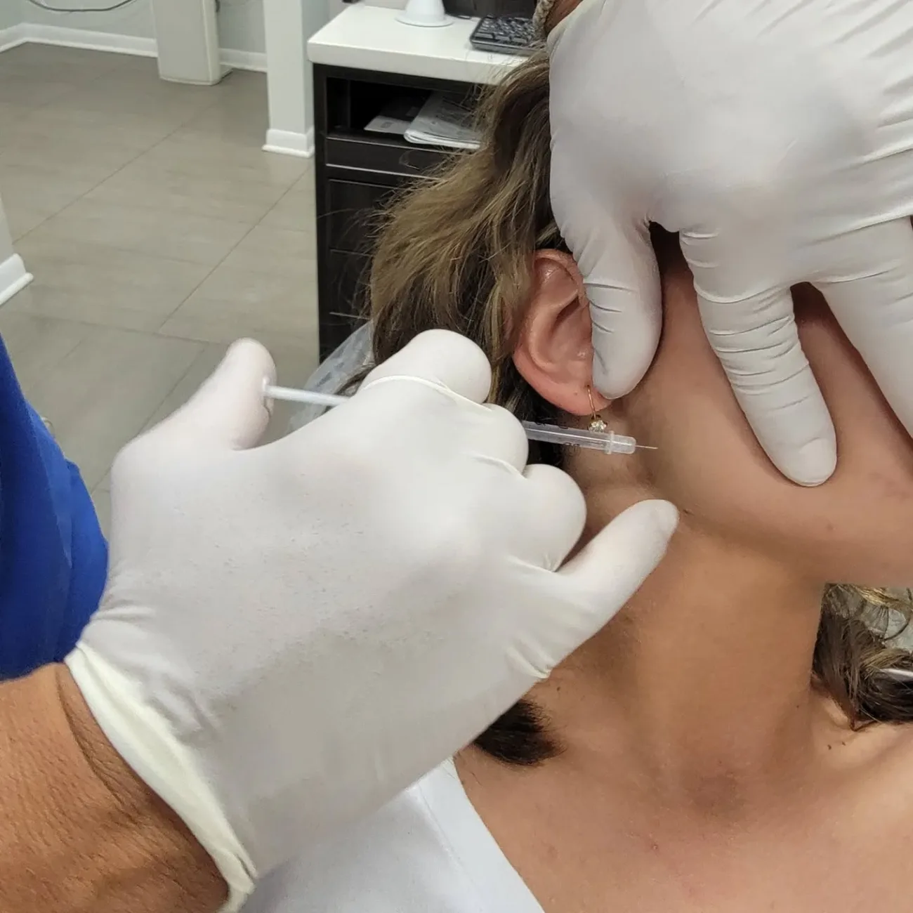 Botox injection into the masseter muscle at the angle of the jaw for clenching and grinding, at Loukas Dentistry of Park Ridge, IL